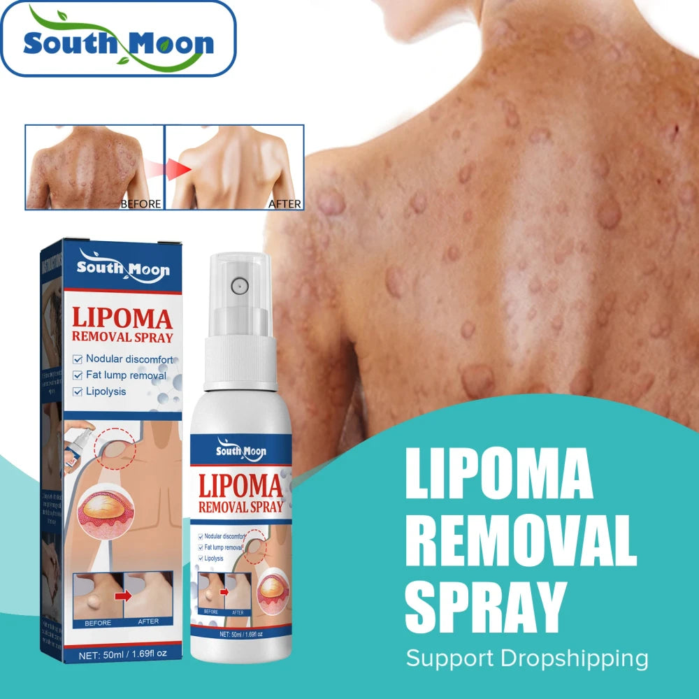 Spray Tratamiento Lipomas Alivio Subcutáneo